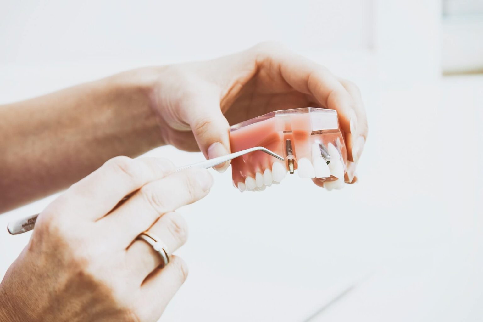 Fibrome im Mund Ursachen, Symptome & Behandlung
