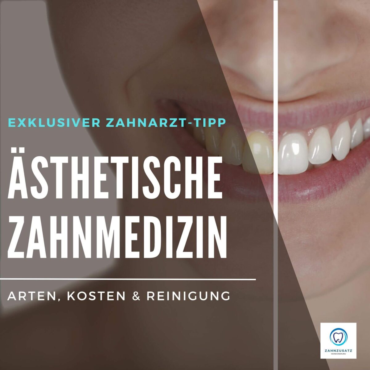 ᐅ Zungenpressen Risiken, Behandlung & Ursachen
