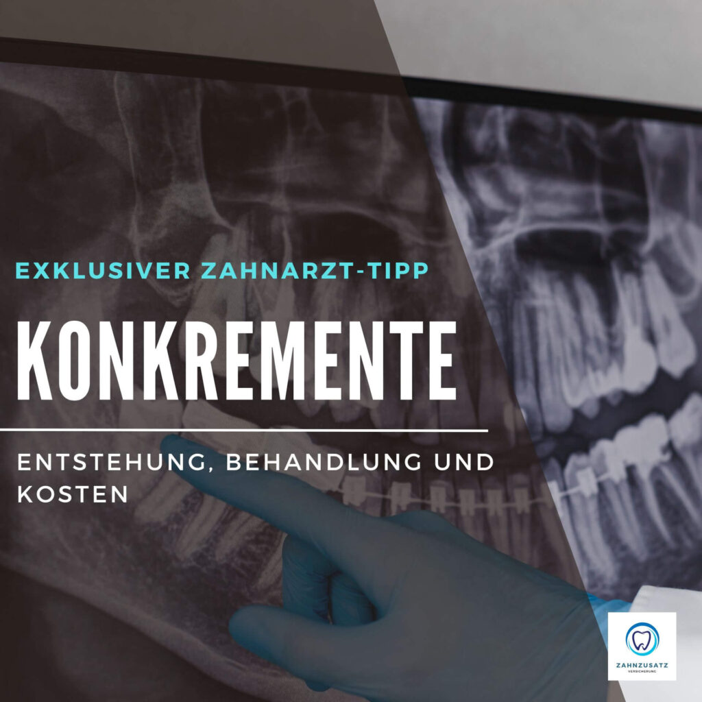 Zahnzusatzversicherung bei angeratener Behandlung Möglich?