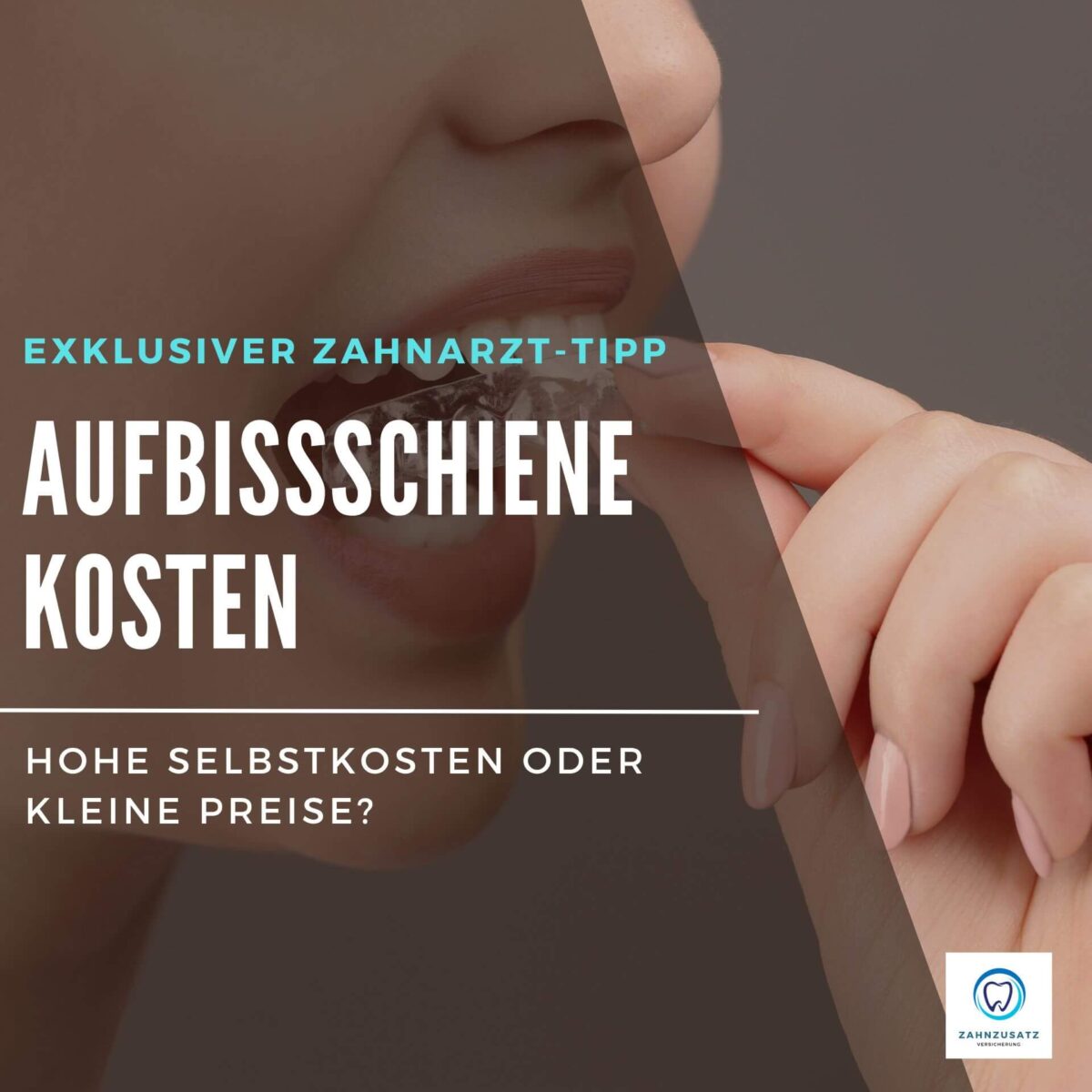 Riss im Zahn Ursachen, Behandlung & Kosten