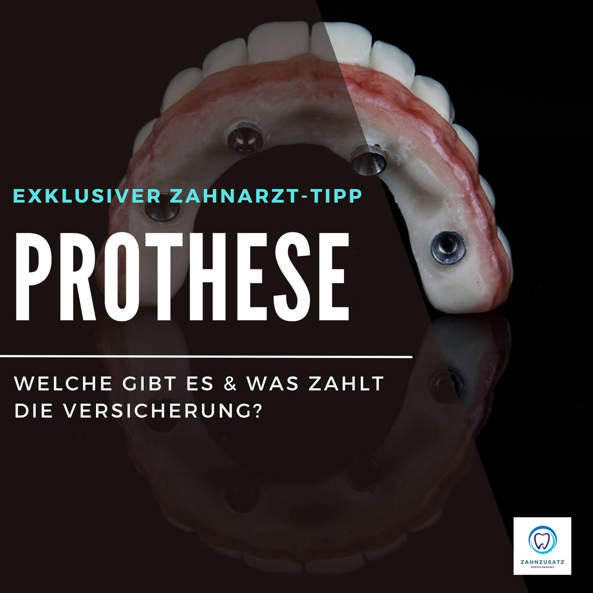 Zahnzusatzversicherung Prothese Was zahlt die Versicherung?