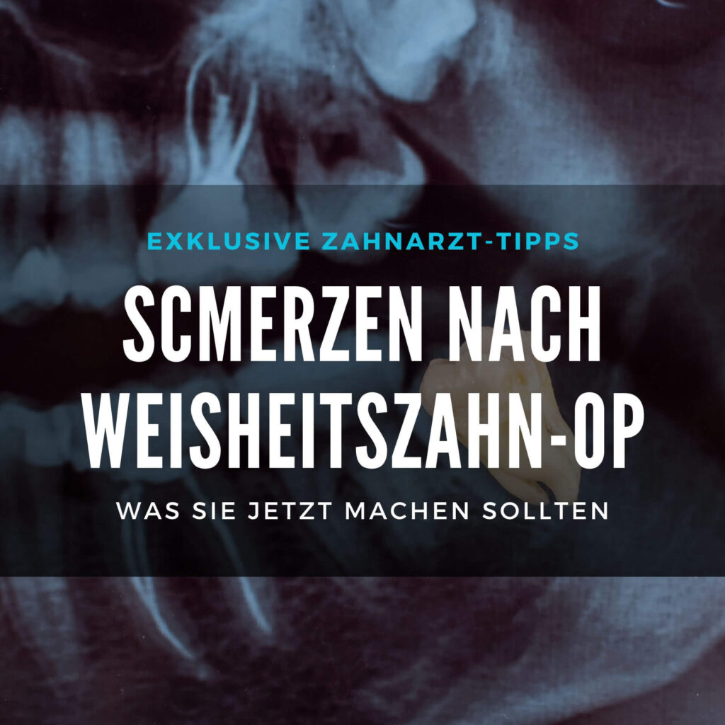 Wie lange kein Sport nach Weisheitszahn OP? Dauer & Tipps