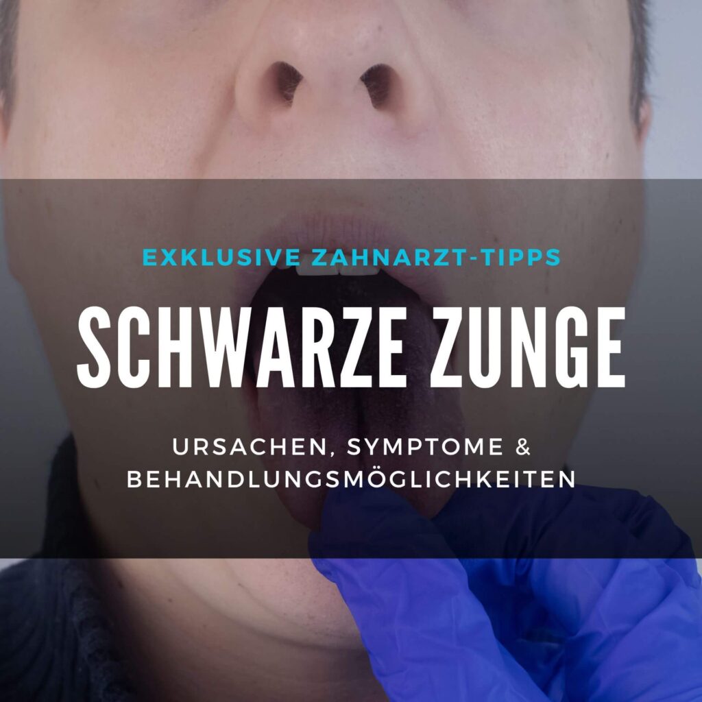 Kleiner Schwarzer Punkt Auf Der Zunge Mensch Schwarze Zunge: Ursachen, Symptome & Behandlung
