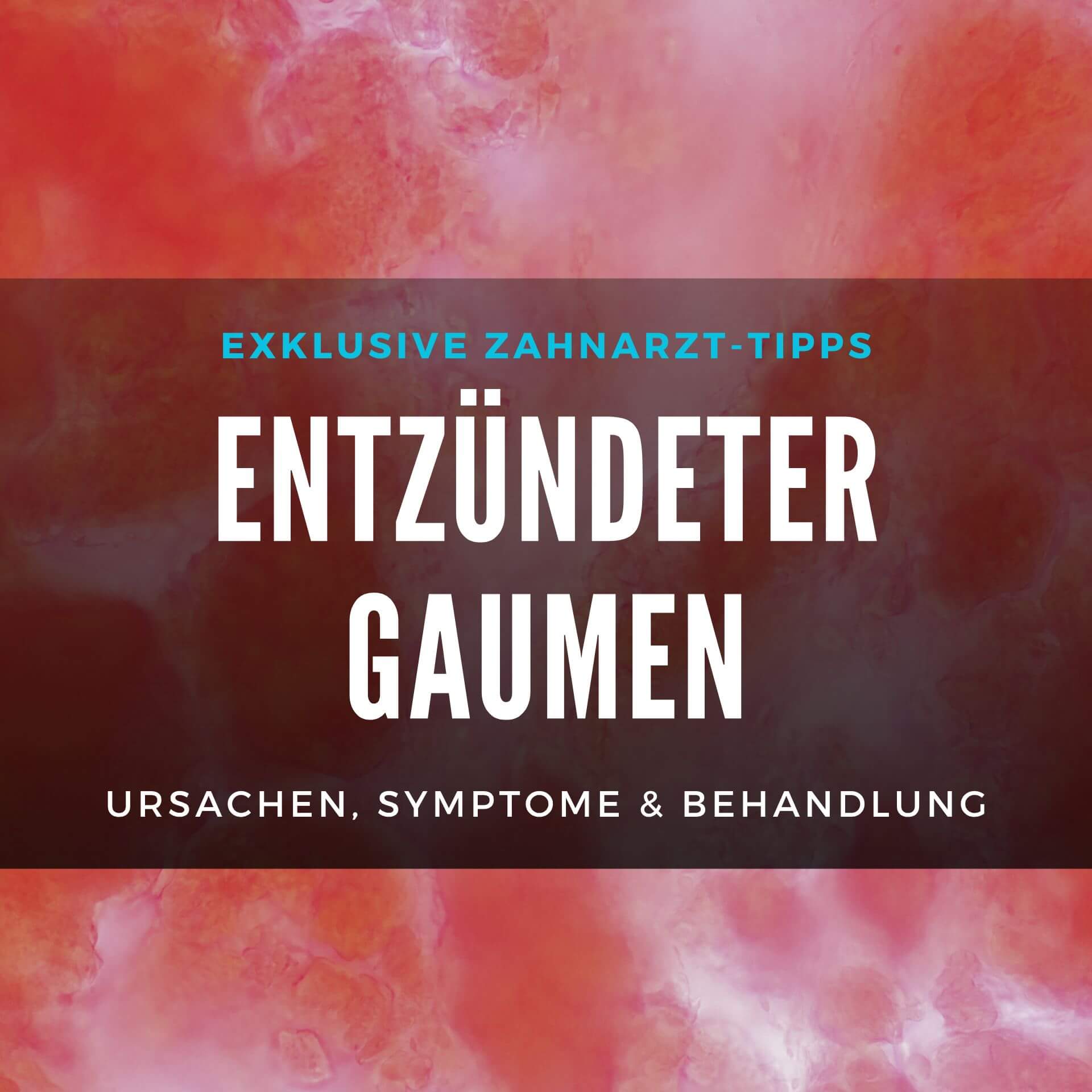 Entzündeter Gaumen: Ursachen, Symptome & Behandlung