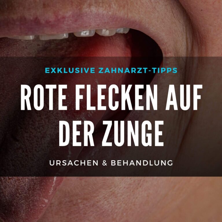 Novaminsulfon Zahnschmerzen Einsatz Und Wirksamkeit Novaminsulfon Zahnschmerzen Einsatz Und Wirksamkeit