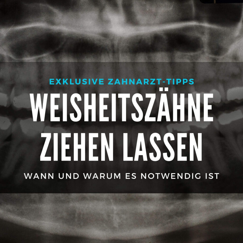Zahnzusatzversicherung bei angeratener Behandlung Möglich?