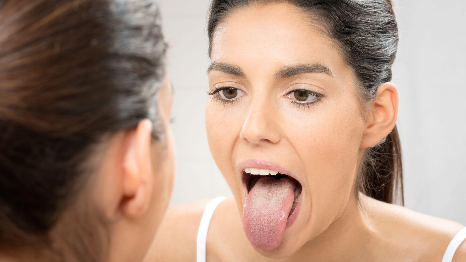 Kleiner Schwarzer Punkt Auf Der Zunge Mensch ᐅ Punkte auf der Zunge: Ursachen, Diagnosen & Behandlung